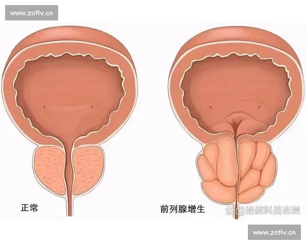 男科健康新趋势:从预防到治疗全面解析男性生殖与泌尿系统疾病的诊疗方法
